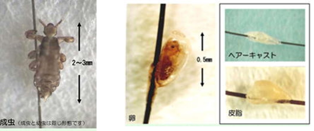 次に何をすべきか